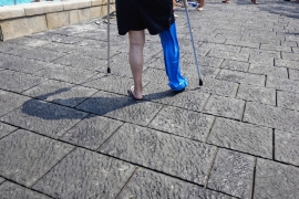 Jambe ou bras cassé : conseils baignade